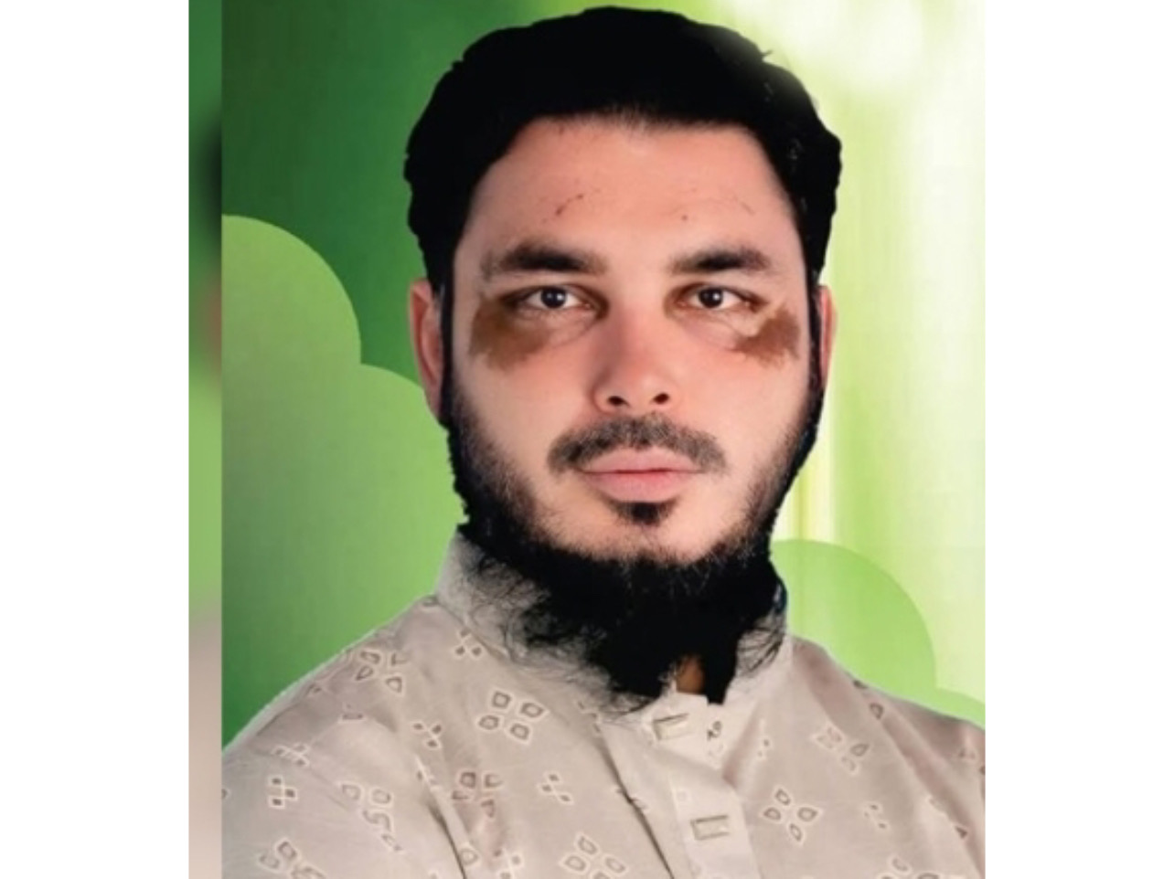 বিশ্ববিদ্যালয় শিক্ষার্থীকে ধর্ষণের হুমকি দেওয়ার অভিযোগ রাজশাহীর স্বেচ্ছাসেবক নেতা শান্ত'র বিরুদ্ধে